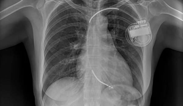 Atlanta Defective Medical Devices Attorneys